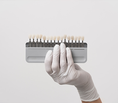 Composite Veneers