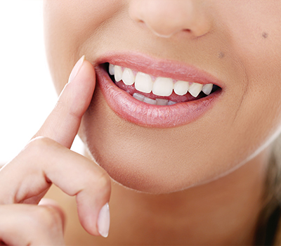 Hollywood Smile